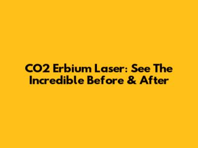 CO2 Erbium Laser: See The Incredible Before & After